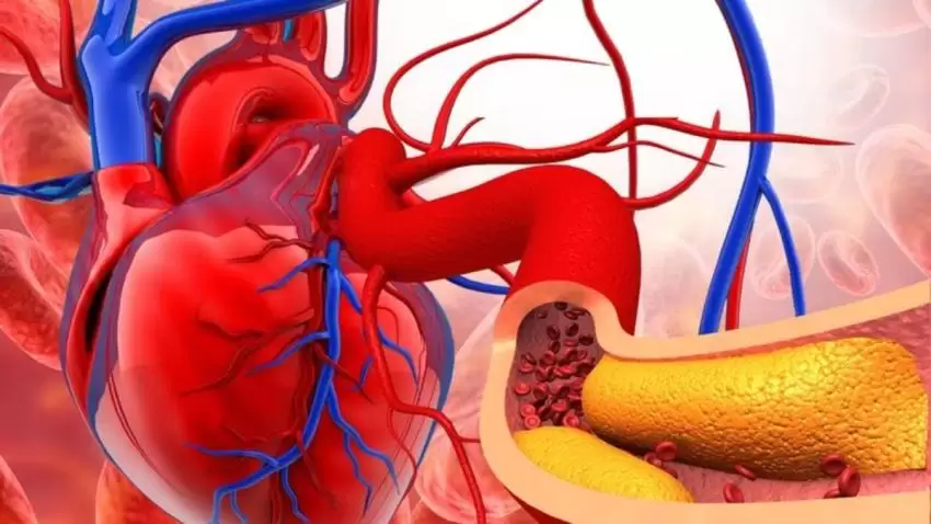 Dos alimentos que protegen las arterias y evitan que se taponen